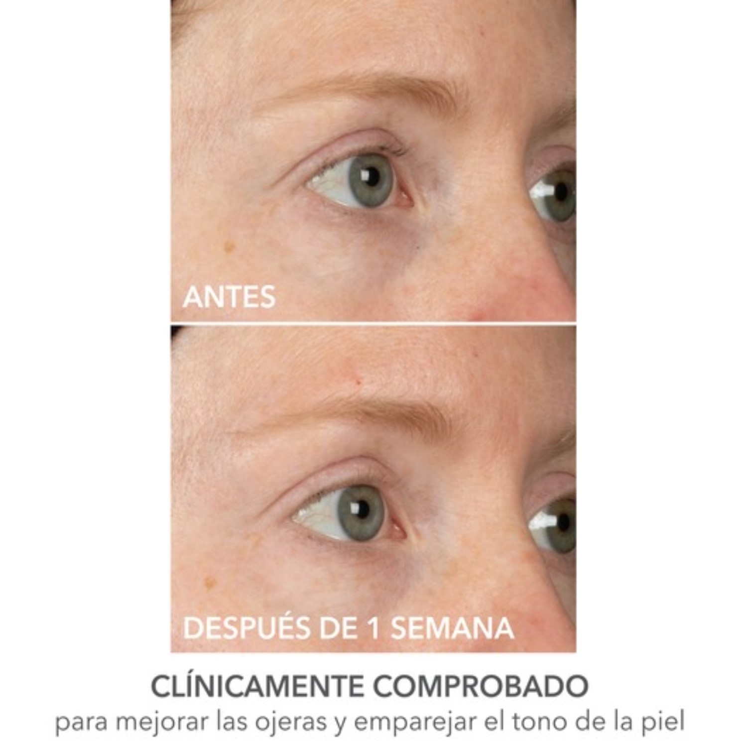 DERMINFUSIONS™ LIFT + REPAIR EYE MASK (MASCARILLA PARA OJOS)